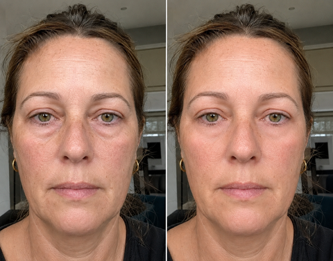 — Isabelle S. , 49 ans