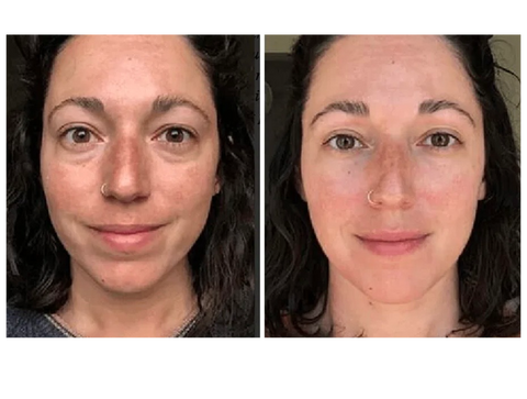 — Nathalie R., 44 ans